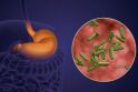 Pavojinga: H. Pylori bakterija kolonizuoja žmogaus skrandį ir atlieka pagrindinį vaidmenį daugelio virškinamojo trakto ligų išsivystyme.