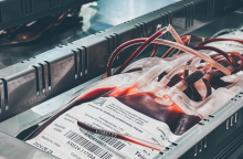 Santaros klinikos prašo atvykti kraujo donorus: ligoms atostogų nėra